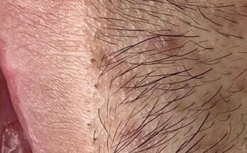 Exploring the Charm and Significance of the Lip Area